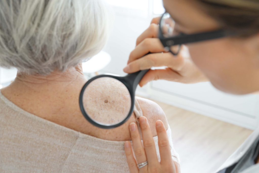 Skin Cancer Prevention: Heightening Awareness